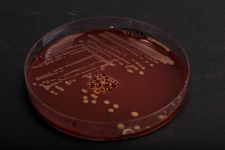 Petri dish with colonies of bacteria and fungi on a black background