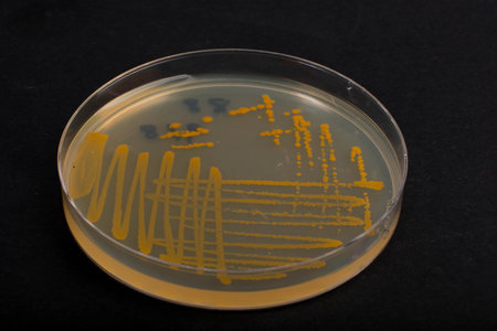 Colonies of Characteristics and Different shaped Colony of Bacteria and Mold growing on agar plate.の写真素材