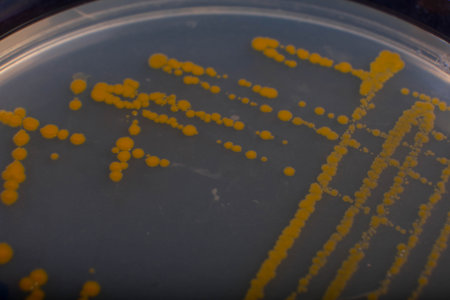 Bacteria colonies on agar plate in petri dish for education.