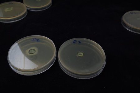 bacterial growth in agar plate to test the ability of adhesion around contact lens