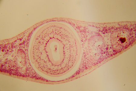 Planaria whole mount slide showing internal organs stainedの写真素材