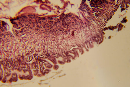 Intestinal wall section showing villi and epithelial lining clearly