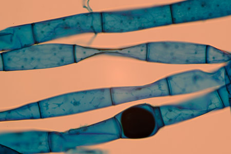 Microscopic view of blue-stained fungal hyphae with spores.の写真素材