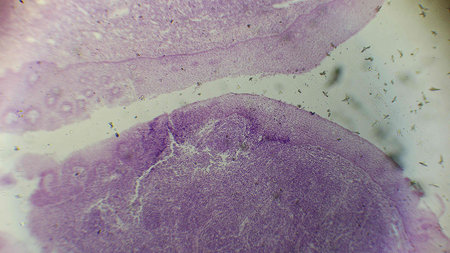 Microscopic view of a biological sample showing purple-stained cells and structures, with some...