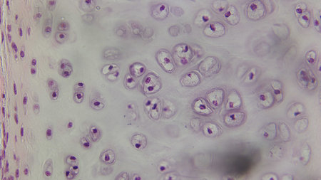 Microscopic view of hyaline cartilage showing chondrocytes in lacunae.