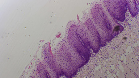 Microscopic view of epithelial tissue with purple staining, showing cellular structure and arrangementの写真素材