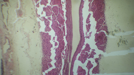 Microscopic view of tissue showing cellular structures and patterns, with pink and white stainingの写真素材