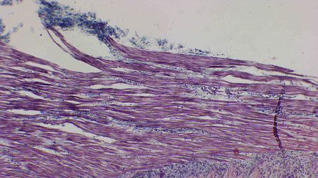 Microscopic view of muscle tissue showing striations and fibers