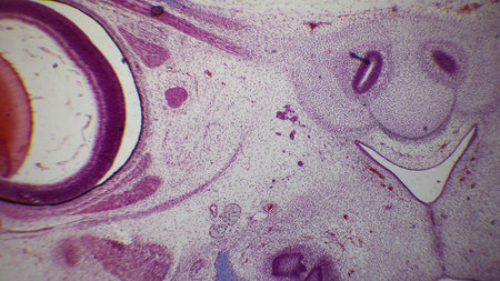 A microscopic view of tissue with various cellular structures, featuring purple and pink staining...