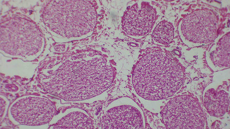 Microscopic view of tissue with pink-stained cells and structures, showing circular formations and a...