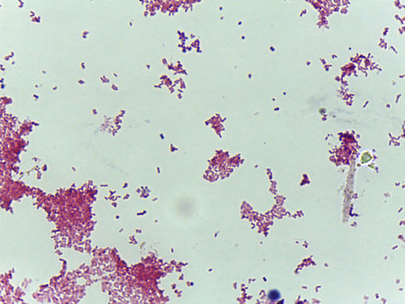 Microscopic Field of Red/Pink Bacteria Clustered in Colonies, Suggesting a Gram-Negative Stain