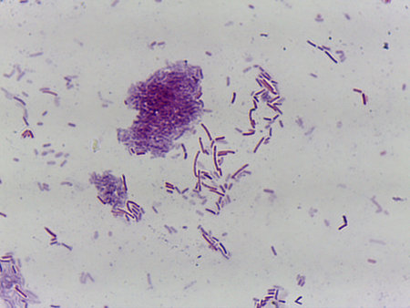 Microscopic Field of Rod-Shaped Bacteria (Bacilli) Showing Scattered Cells and Clusters