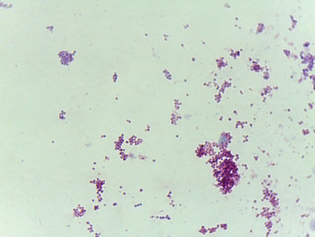 Microscopic Field of Purple Rod-Shaped Bacteria (Bacilli) Scattered on a Slide