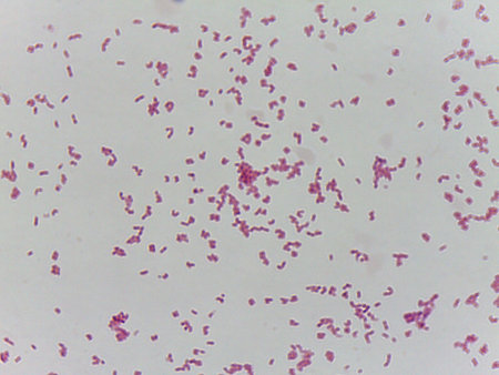 Microscopic Field of Purple Rod-Shaped Bacteria (Bacilli) Scattered on a Slide