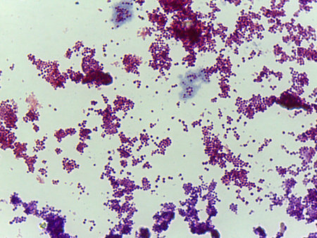 Microscopic Field of Purple Rod-Shaped Bacteria (Bacilli) Scattered on a Slide