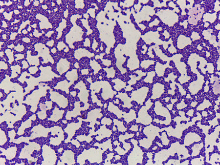 Microscopic Field of Purple Rod-Shaped Bacteria (Bacilli) in Dense, Clustered Colonies