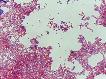Microscopic Field of Red/Pink Bacteria Clustered in Colonies, Suggesting a Gram-Negative Stain