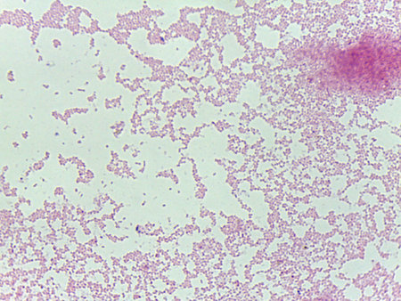 Microscopic Field of Red/Pink Bacteria Clustered in Colonies, Suggesting a Gram-Negative Stain