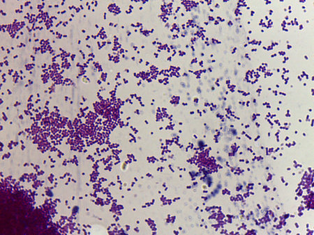 Microscopic Field of Purple Rod-Shaped Bacteria (Bacilli) in Dense, Clustered Colonies