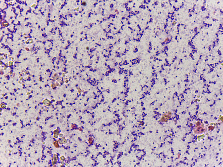 Microscopic Field of Purple Rod-Shaped Bacteria (Bacilli) in Dense, Clustered Colonies