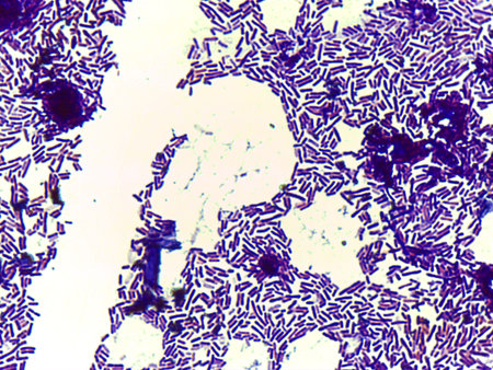 Microscopic Section of Lymphoid Tissue Showing Contrasting Follicle Zones