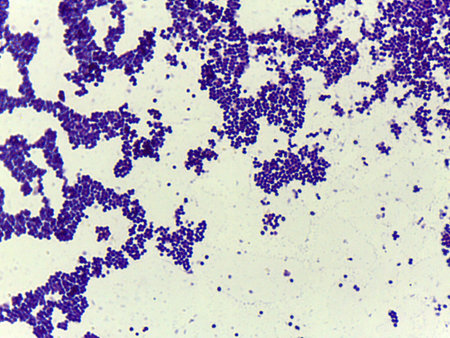 Microscopic Field of Purple Spherical Bacteria (Cocci) in Grapelike Clusters