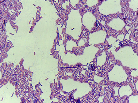 Dense Clusters of Rod-Shaped Bacteria (Bacilli) with Clear Patches, Under High Magnification