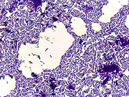 Microscopic Section of Lymphoid Tissue Showing Contrasting Follicle Zones