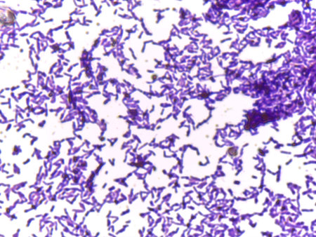 Microscopic Section of Lymphoid Tissue Showing Contrasting Follicle Zones