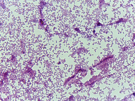 Microscopic Field of Purple Rod-Shaped Bacteria (Bacilli) Scattered on a Slide