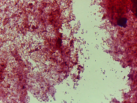 Microscopic Section of Lymphoid Tissue Showing Contrasting Follicle Zones
