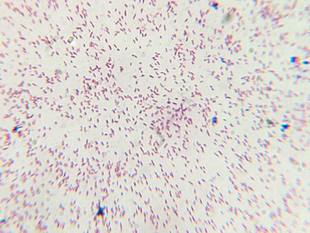 Microscopic View of Purple Cocci Bacteria Clustered in Grapelike Formations