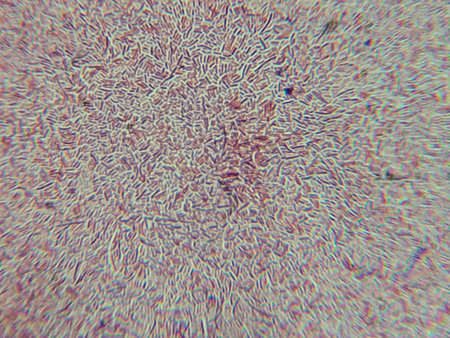 Dense Clumps of Rod-Shaped Bacteria (Bacilli) Under a Microscope
