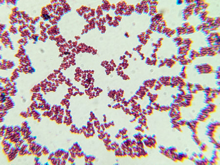 Microscopic View of Purple Cocci Bacteria Clustered in Grapelike Formations