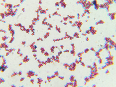 Microscopic View of Purple Cocci Bacteria Clustered in Grapelike Formationsの写真素材