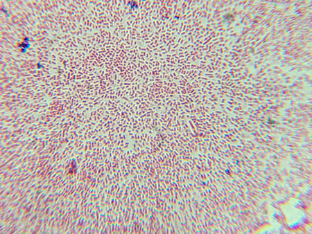 Microscopic View of Purple Cocci Bacteria Clustered in Grapelike Formations