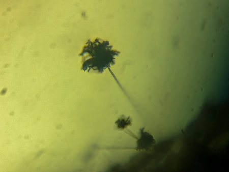 Microscopic View of Filamentous Fungi with Stalked Spore Heads on a Surfaceの写真素材