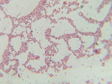 Dense Clumps of Rod-Shaped Bacteria (Bacilli) Under a Microscope