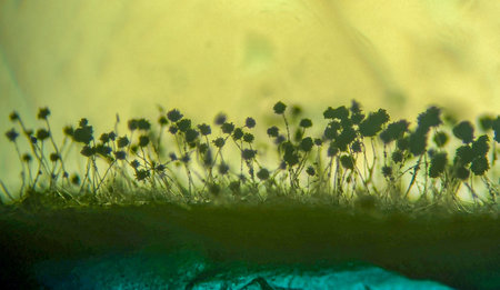 Microscopic Silhouette of Black Mold Fungi (Aspergillus niger or Rhizopus) with Sporangia