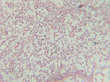 Dense Clumps of Rod-Shaped Bacteria (Bacilli) Under a Microscope