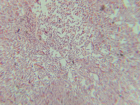 Dense Clumps of Rod-Shaped Bacteria (Bacilli) Under a Microscope