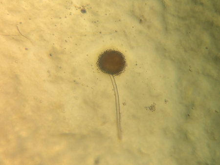 Microscopic View of a Fungal Structure (Aspergillus or Mucor) with a Sporangium and Stalkの写真素材