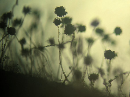 Microscopic Silhouette of Black Mold Fungi (Aspergillus niger or Rhizopus) with Sporangiaの写真素材