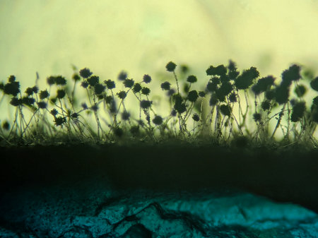 Microscopic Silhouette of Black Mold Fungi (Aspergillus niger or Rhizopus) with Sporangiaの写真素材