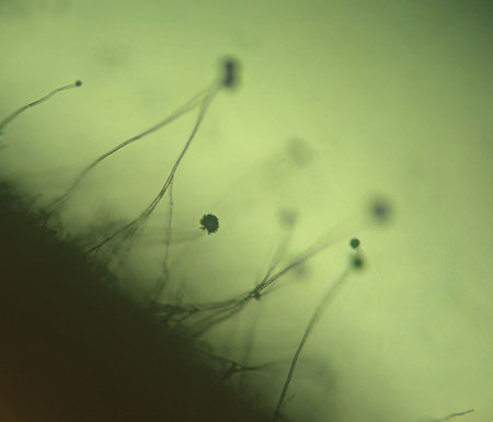 Microscopic Silhouette of Black Mold Fungi (Aspergillus niger or Rhizopus) with Sporangiaの写真素材