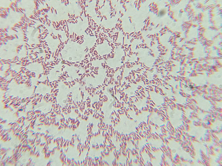 Dense Clumps of Rod-Shaped Bacteria (Bacilli) Under a Microscopeの写真素材