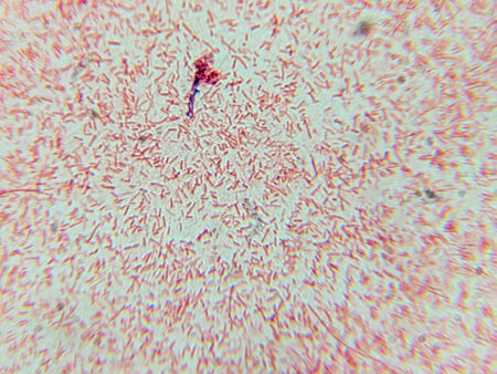 Microscopic View of Purple Cocci Bacteria Clustered in Grapelike Formationsの写真素材