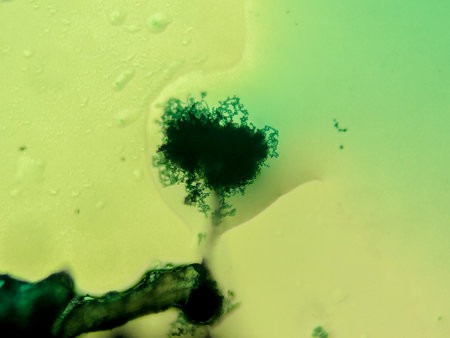 Microscopic View of a Dark Fungal Spore Mass with Peripheral Chainsの写真素材