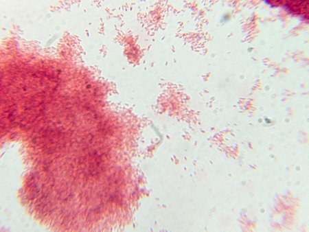 Microscopic View of Purple Cocci Bacteria Clustered in Grapelike Formations