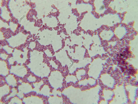 Microscopic View of Purple Cocci Bacteria Clustered in Grapelike Formations